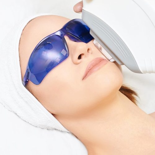 Laser,Facial,Hair,Removal.,Cosmetology,Ipl,Device.,Woman,Body,In